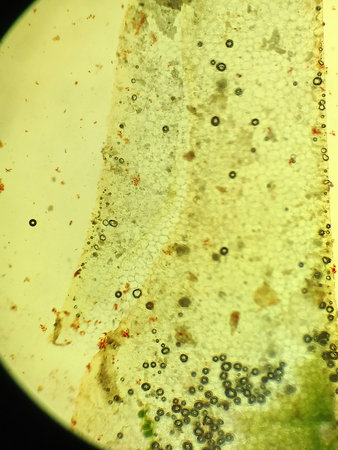 Microscopic structure of sample surface with bacterial spots and organic particles viewed through...