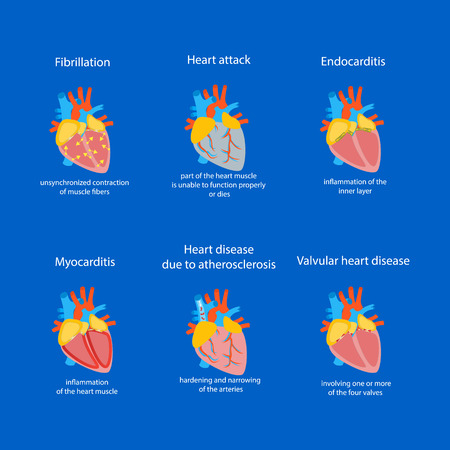 Cartoon Heart Disease Set. Vectorのイラスト素材