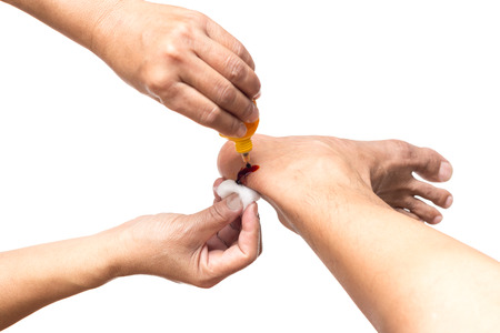 Nurse cleans a wound with an iodine isolated in white backgroundの写真素材