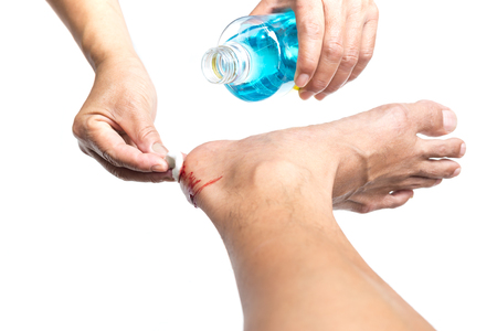 Nurse cleaning blood on patient with  Isopropyl alcohol isolated in white background clipping pathの写真素材