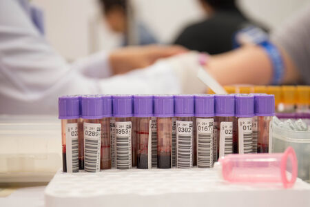 Blood sampling,blood tube for test.