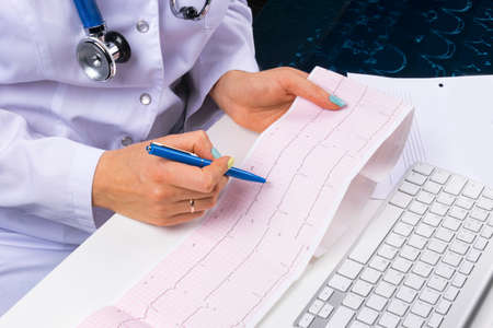 Doctor workplace. Electrocardiogram, ecg in hand of a female doctor with ekg graph paper in hospital office room with computer, concept of medical healthcareの写真素材