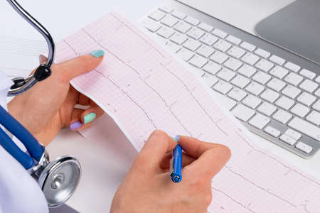 Doctor workplace. Electrocardiogram, ecg in hand of a female doctor with ekg graph paper in hospital...