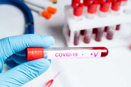 Positive coronavirus blood test concept. Analyzing blood sample in test tube for coronavirus test in...