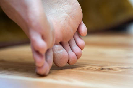 Closeup of woman feet sole with dry cracked skin. Foot and toes care concept.の写真素材