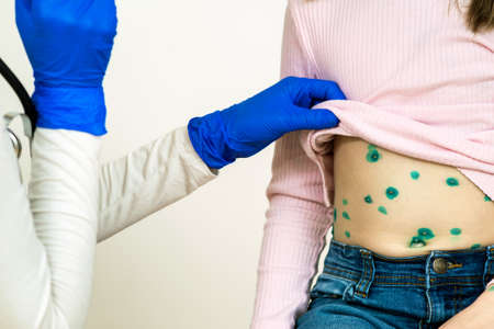 Doctor examining a child covered with green rashes on stomach ill with chickenpox, measles or...