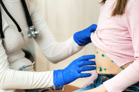 Doctor examining a child covered with green rashes on stomach ill with chickenpox, measles or...