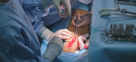 Closeup of doctors hands operating a patient conducting open cut surgery in surgical room. Healthcare and medical intervention conceptの写真素材