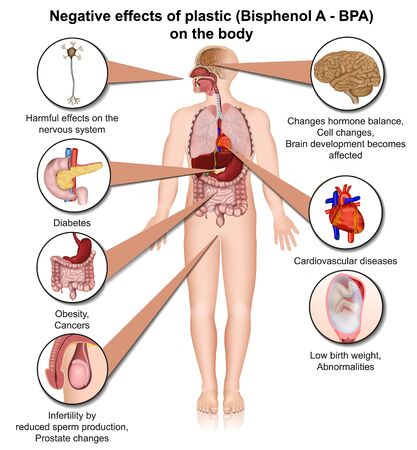 Bisphenol a effects on the human body 3d medical vector illustration isolated on white backgroundのイラスト素材