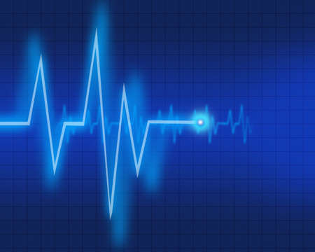 Electrocardiogramの写真素材