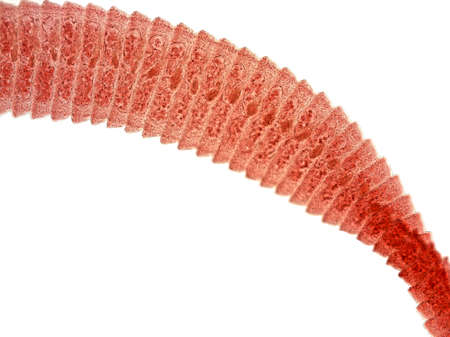 Parasitic flatworms in humans. Dwarf tapeworm (Hymenolepis nana, also known as Rodentolepis nana,...