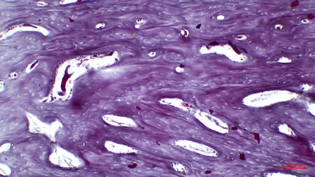 Human compact bone, showing Haversian canals.
