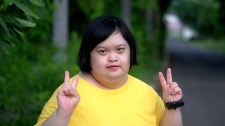 Asian young female Down syndrome two thumb up smile while exercising in the park.の写真素材