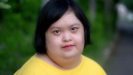 Asian young female Down syndrome two thumb up smile while exercising in the park.の写真素材