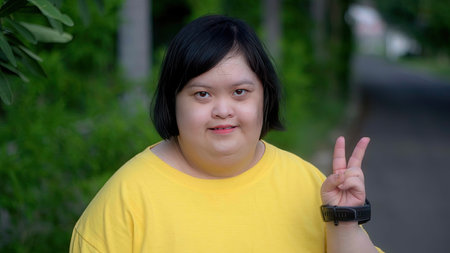 Asian young female Down syndrome two thumb up smile while exercising in the park.の写真素材