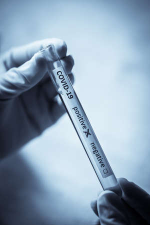 Conceptual photograph of a doctor's hands holding and looking at a test tube while with positive samples for the presence of coronavirus (COVID-19).の写真素材