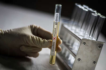 Conceptual photograph of a doctor's hands holding and looking at a test tube while with positive...