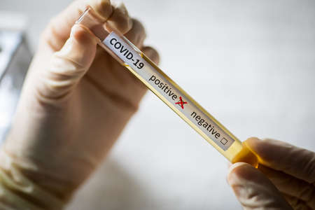 Conceptual photograph of a doctor's hands holding and looking at a test tube while with positive...