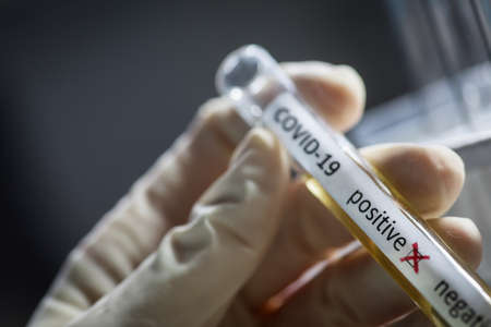 Conceptual photograph of a doctor's hands holding and looking at a test tube while with positive...