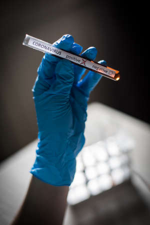 Conceptual photograph of a doctor's hands holding and looking at a test tube while with positive samples for the presence of coronavirus (COVID-19).の写真素材