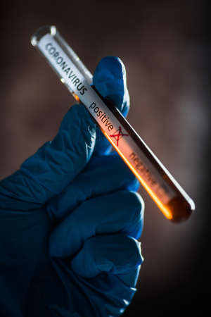 Conceptual photograph of a doctor's hands holding and looking at a test tube while with positive samples for the presence of coronavirus (COVID-19).の写真素材