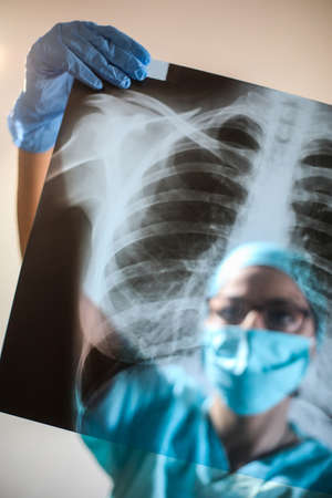 Conceptual image of a doctor holding and analyzing an x-ray of some lungs.の写真素材
