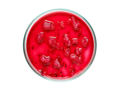 Petri dish with various bacteria isolated on white