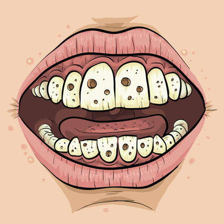 A close up of a cartoon mouth with teeth with lots of cavities. の写真素材