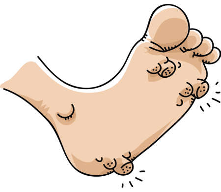 A cartoon foot with plantar warts.のイラスト素材