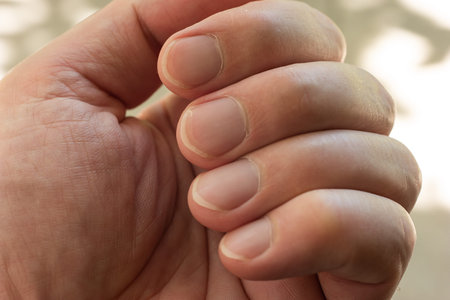 Unkempt overgrown Caucasian male finger nails macro close up shot shallow depth of field.