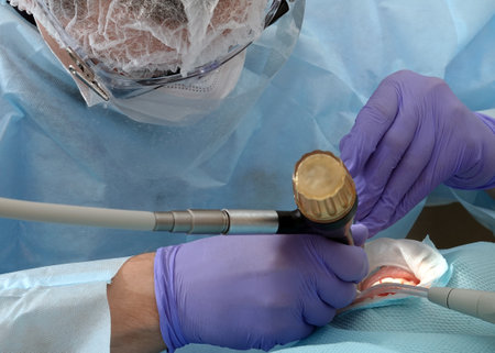 Kiev, Ukraine August 22, 2020: Dentist doctor works with a patient close-upのeditorial素材