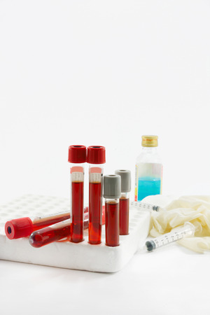 Blood sample in tube blood for screening test and syringe on white background.の写真素材