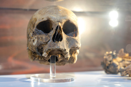 Aksaray / Turkey - July 07 2019: Human skull exposed in a museum