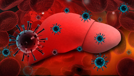 Liver Infection with hepatitis viruses Liver Infection with hepatitis viruses