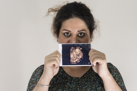 Woman holding unborn baby sonography image in hands, in front of her face.のeditorial素材