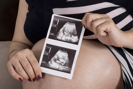 Woman holding unborn baby ultrasound X-Ray image in hands in front of belly.