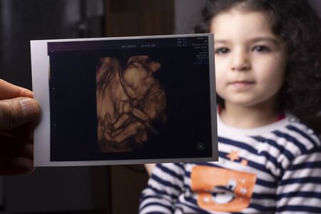 Selective focus of an unborn baby sonography image in front of two years old girlの写真素材