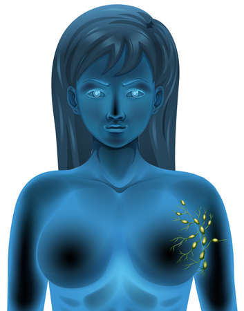 Female body lymph nodes illustrationのイラスト素材