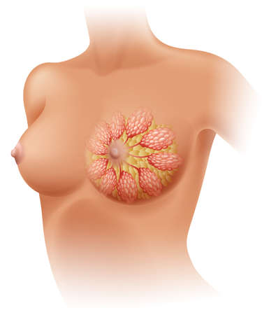 Breast cancer diagram in detail illustrationのイラスト素材
