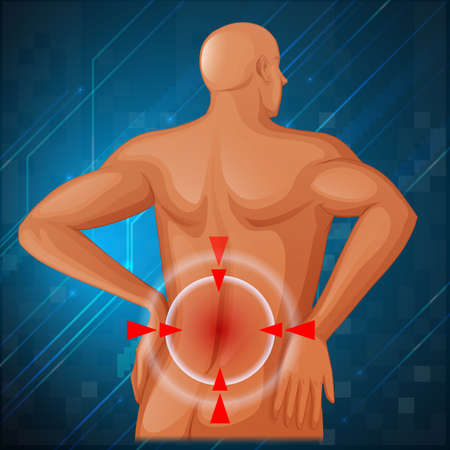 Spine pain in the back illustrationのイラスト素材