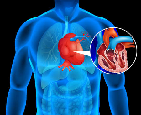 Human heart with cancer illustrationのイラスト素材