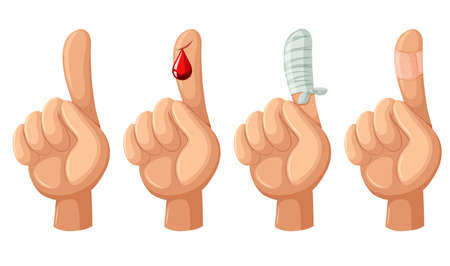 Finger with cut and bandages illustrationのイラスト素材