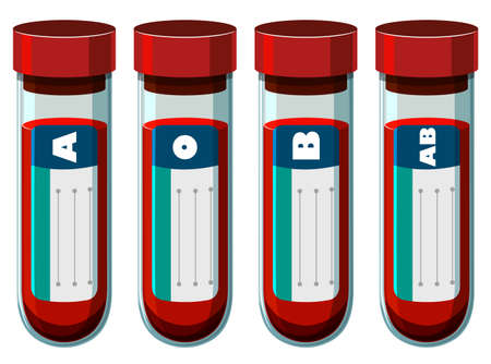 Different blood types in test tube illustrationのイラスト素材