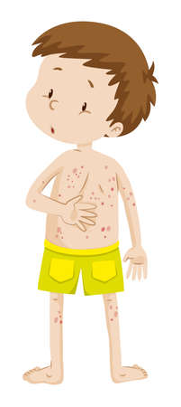 Little boy with rashes in his back illustrationのイラスト素材
