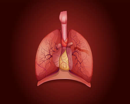 Diagram showing lungs with disease illustration
