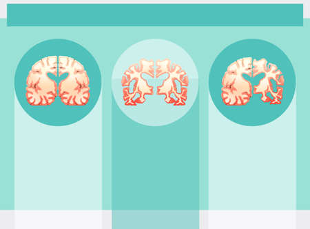 Background template with human brains illustrationのイラスト素材