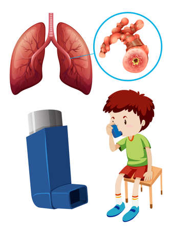 Boy with unhealthy lungs illustrationのイラスト素材