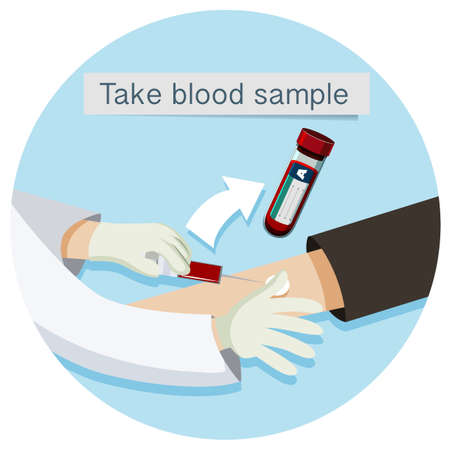 Health Care Take Blood Sample illustrationのイラスト素材