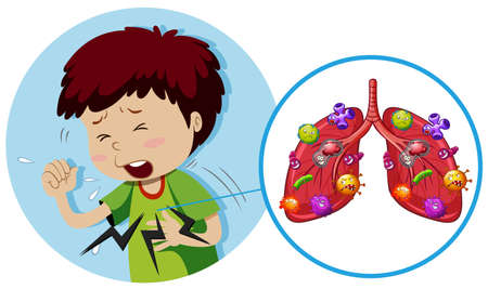 Young boy with bacteria on lungs illustrationのイラスト素材