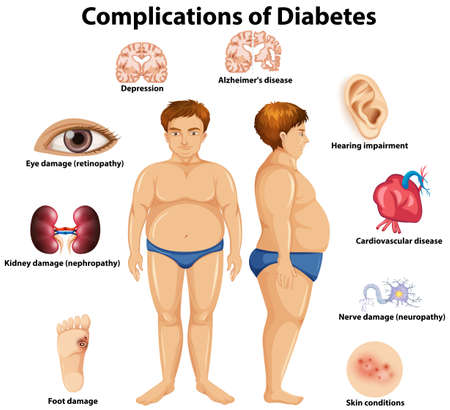 Complications of Diabetes concept illustrationのイラスト素材